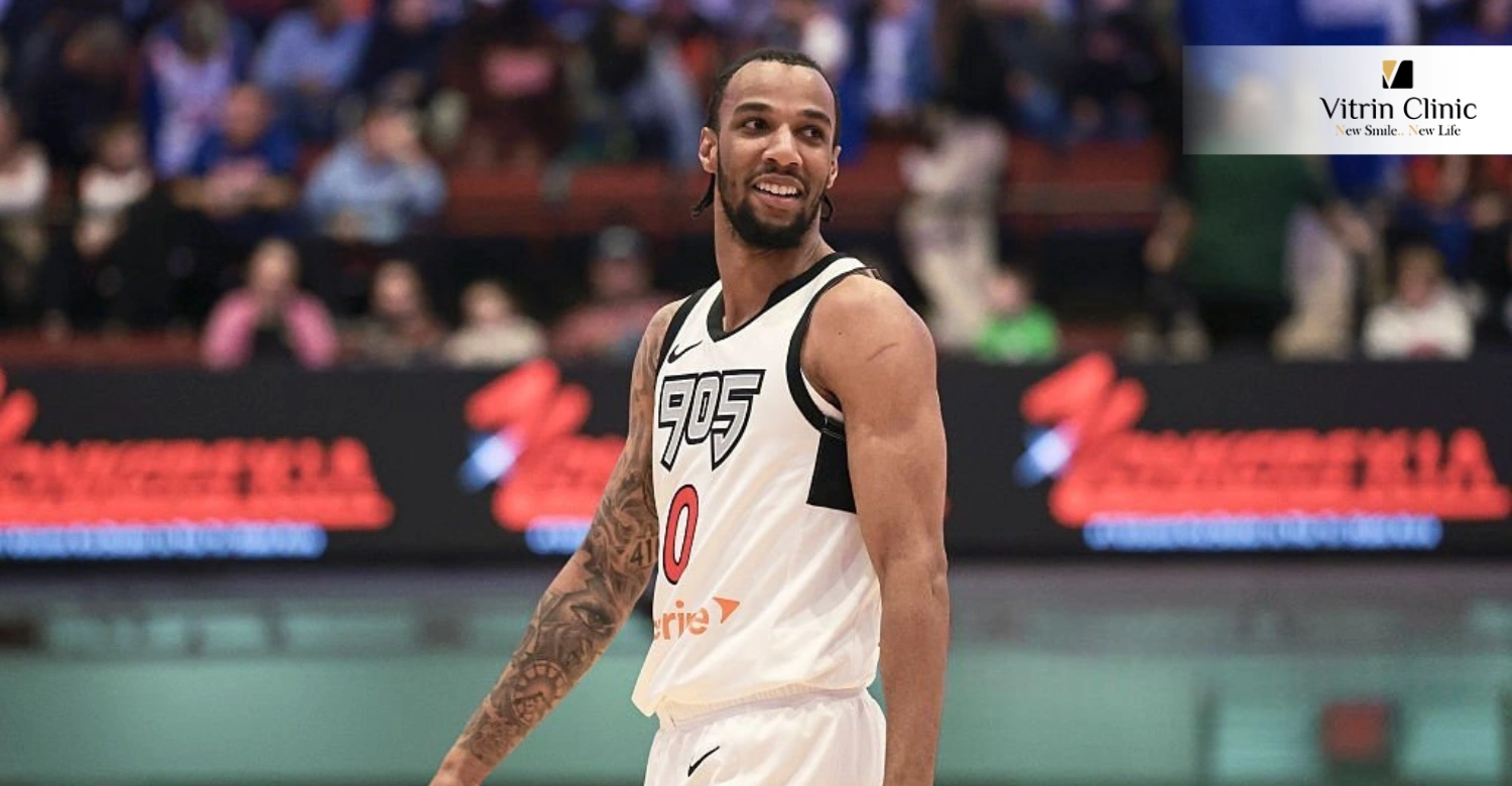 How A.J. Lawson Built His Iconic NBA Smile: Secrets, Transformations, and Tips